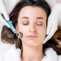 Microneedling: Everything You Need to Know
