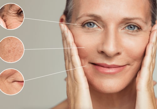 Everything You Need to Know About Fractional Laser Therapy