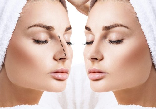 Closed Rhinoplasty: Everything You Need to Know